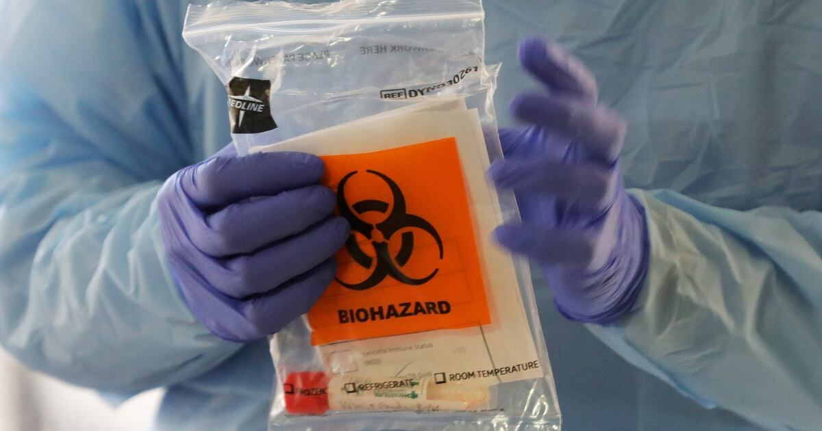 Explainer How Do You Test For Coronavirus