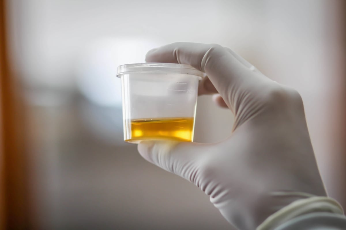 Urine sample odor that prompted evacuation of VA medical center was