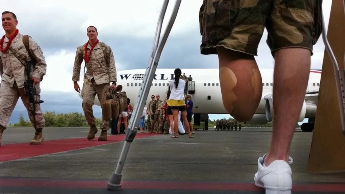Their military careers were cut short in combat. Now they’re fighting Congress for their full benefits. Their military careers were cut short in combat. Now they’re fighting Congress for their full benefits.